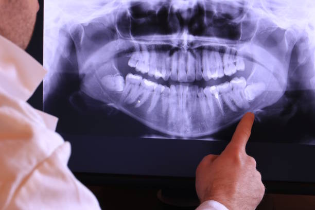 Best Emergency Treatment for Oral Infections in Morrisville, NY